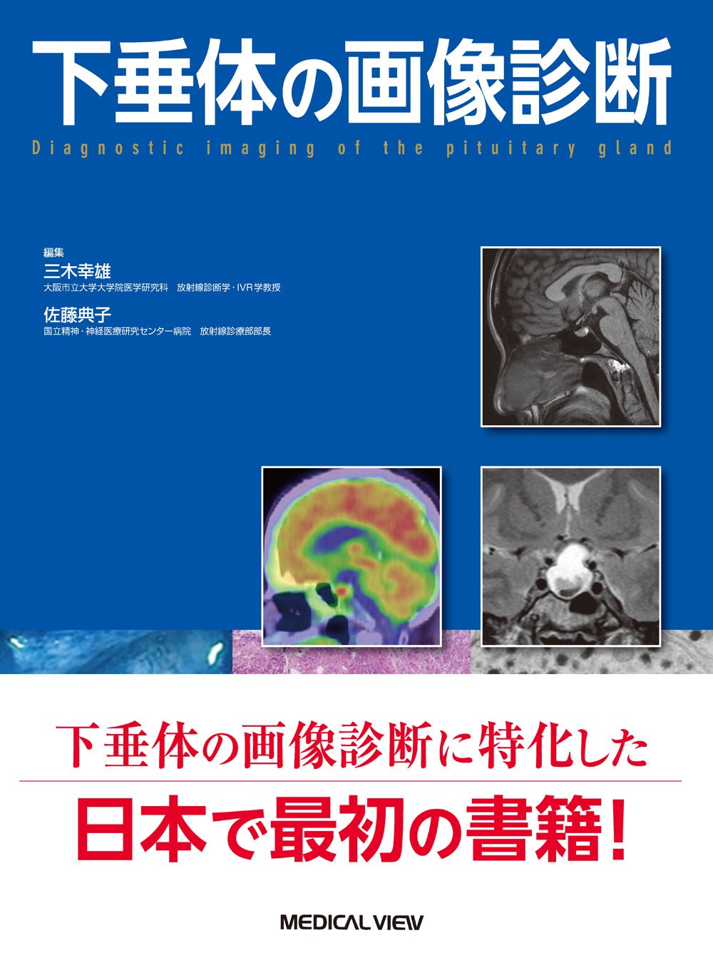 「下垂体の画像診断」という本が刊行の運びとなりました。当教室の医局員が、編集・執筆の多くを担当しました。